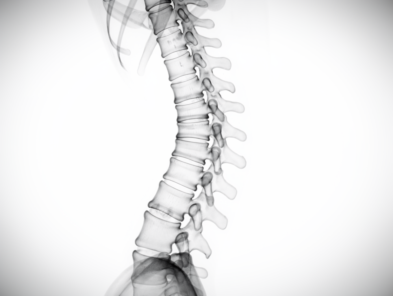 Physician reviewing complex diagnostic imaging for legal case analysis